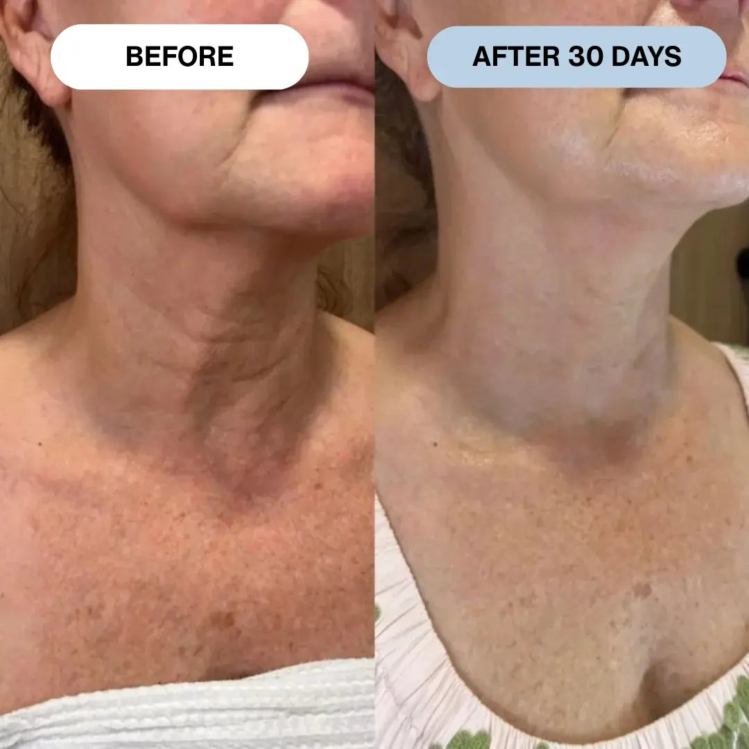 Ryte Copper Peptide Micro-Infusion System