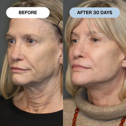 Ryte Copper Peptide Micro-Infusion System