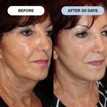 Ryte Copper Peptide Micro-Infusion System