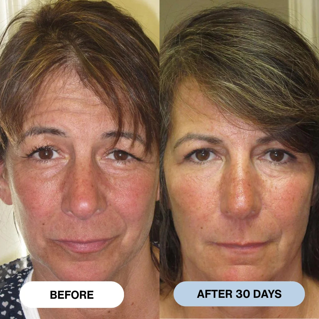 Ryte™ Copper Peptide Micro-Infusion System