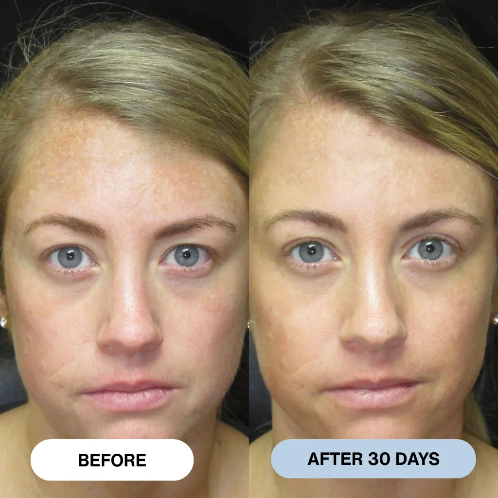 Ryte™ Copper Peptide Micro-Infusion System