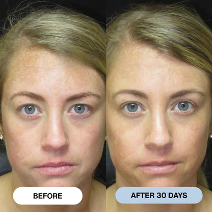 Ryte™ Copper Peptide Micro-Infusion System