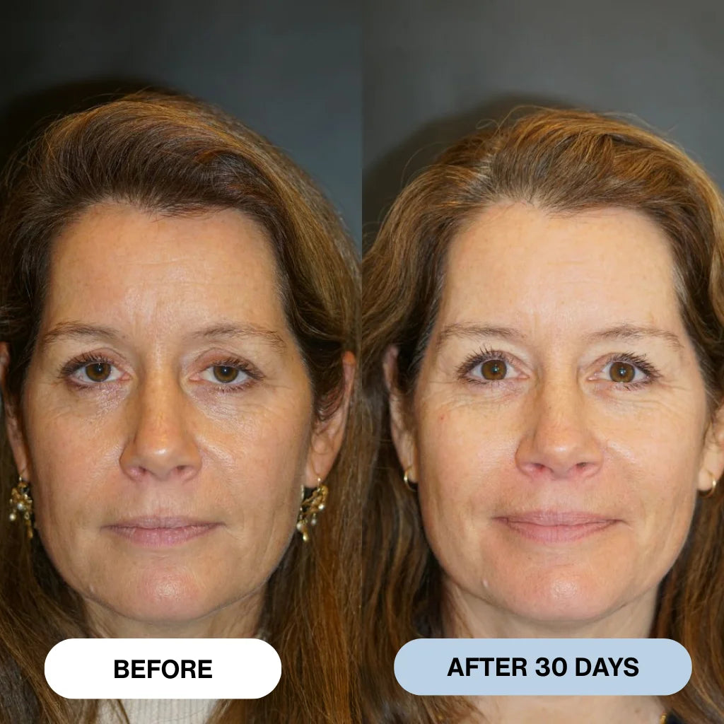 Ryte™ Copper Peptide Micro-Infusion System