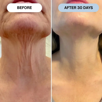 Ryte Copper Peptide Micro-Infusion System