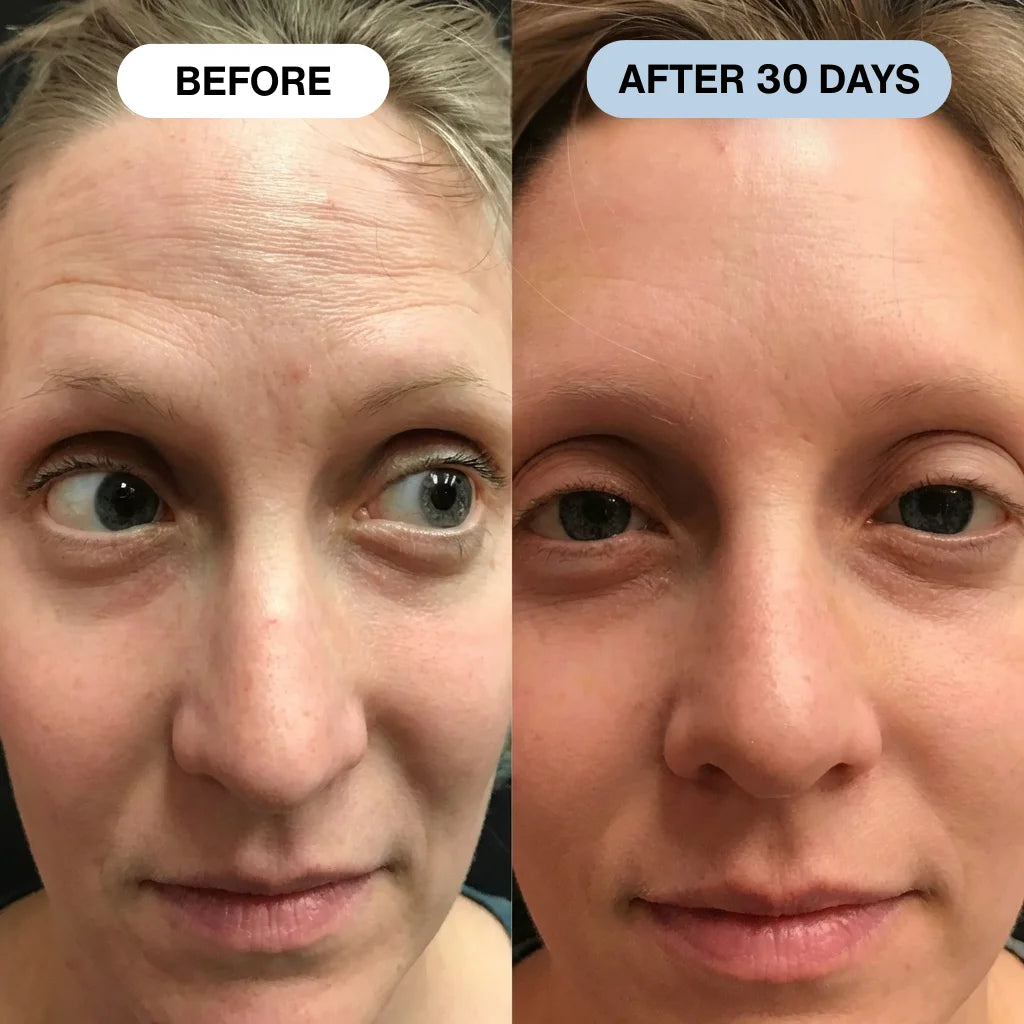 Ryte Copper Peptide Micro-Infusion System