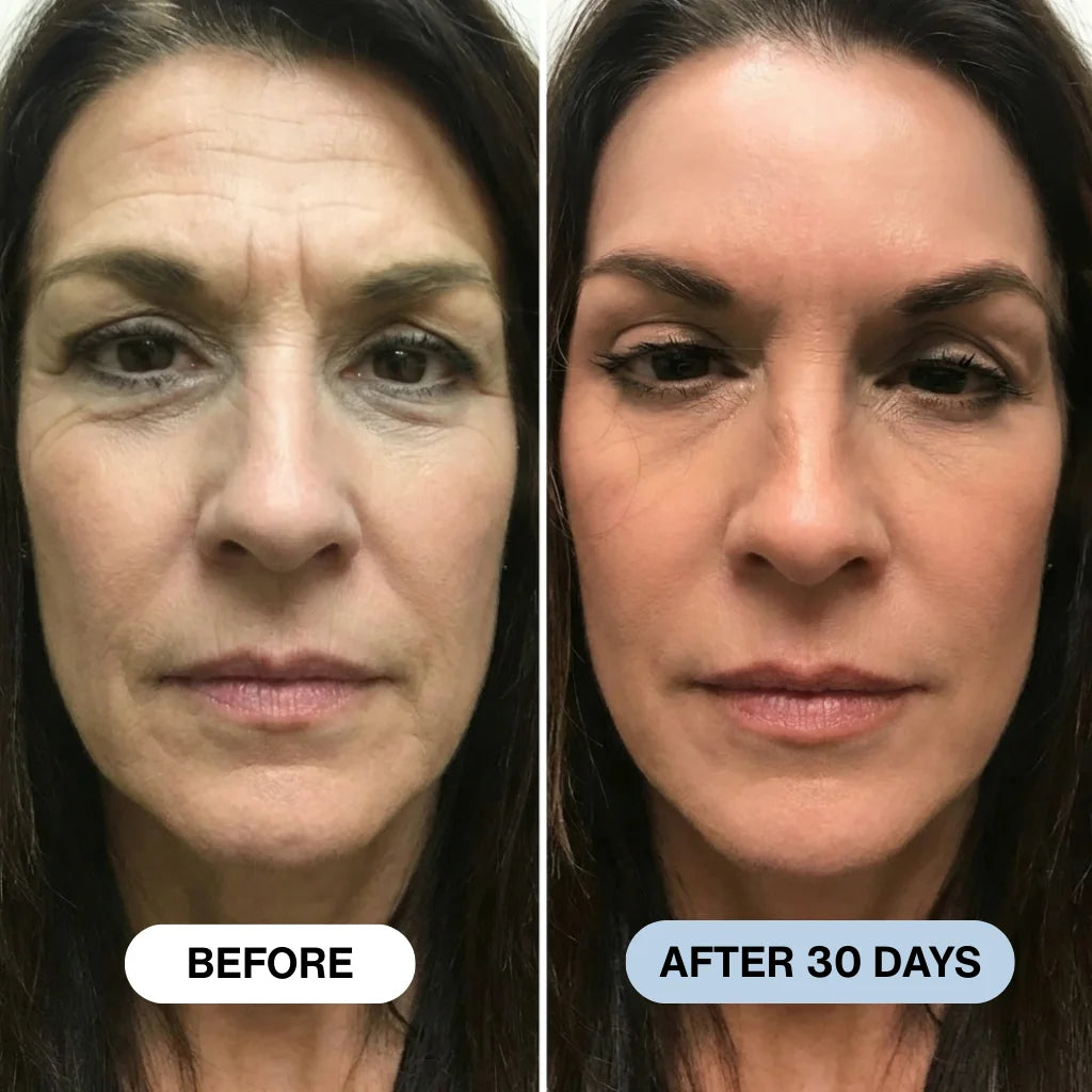 Ryte Copper Peptide Micro-Infusion System