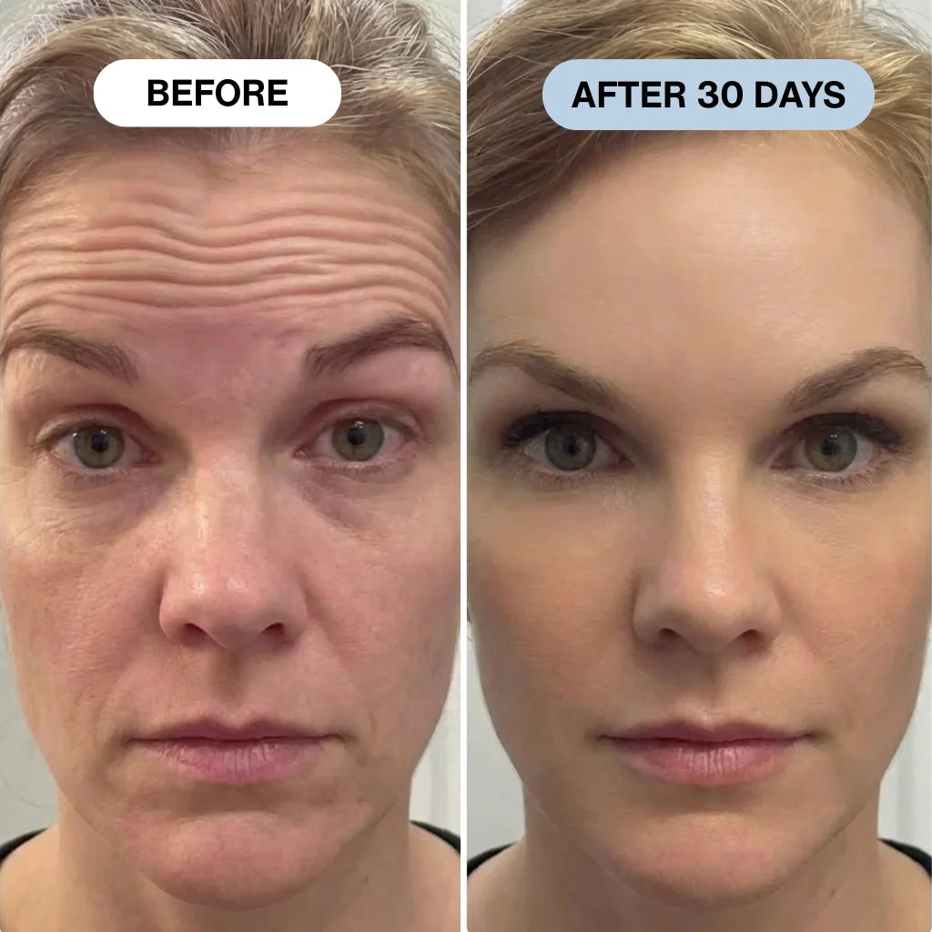 Ryte Copper Peptide Micro-Infusion System