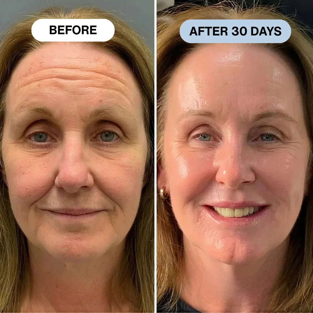 Ryte Copper Peptide Micro-Infusion System