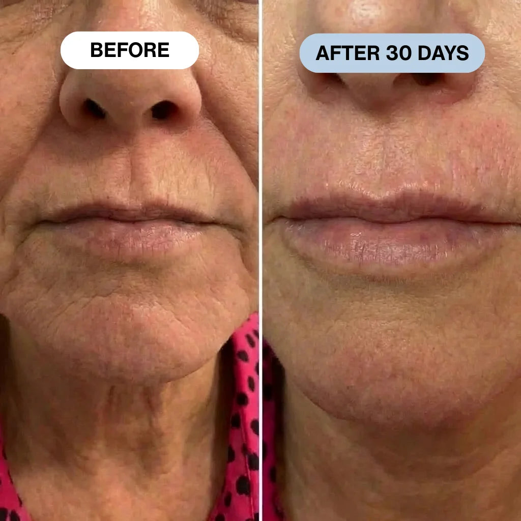 Ryte Copper Peptide Micro-Infusion System