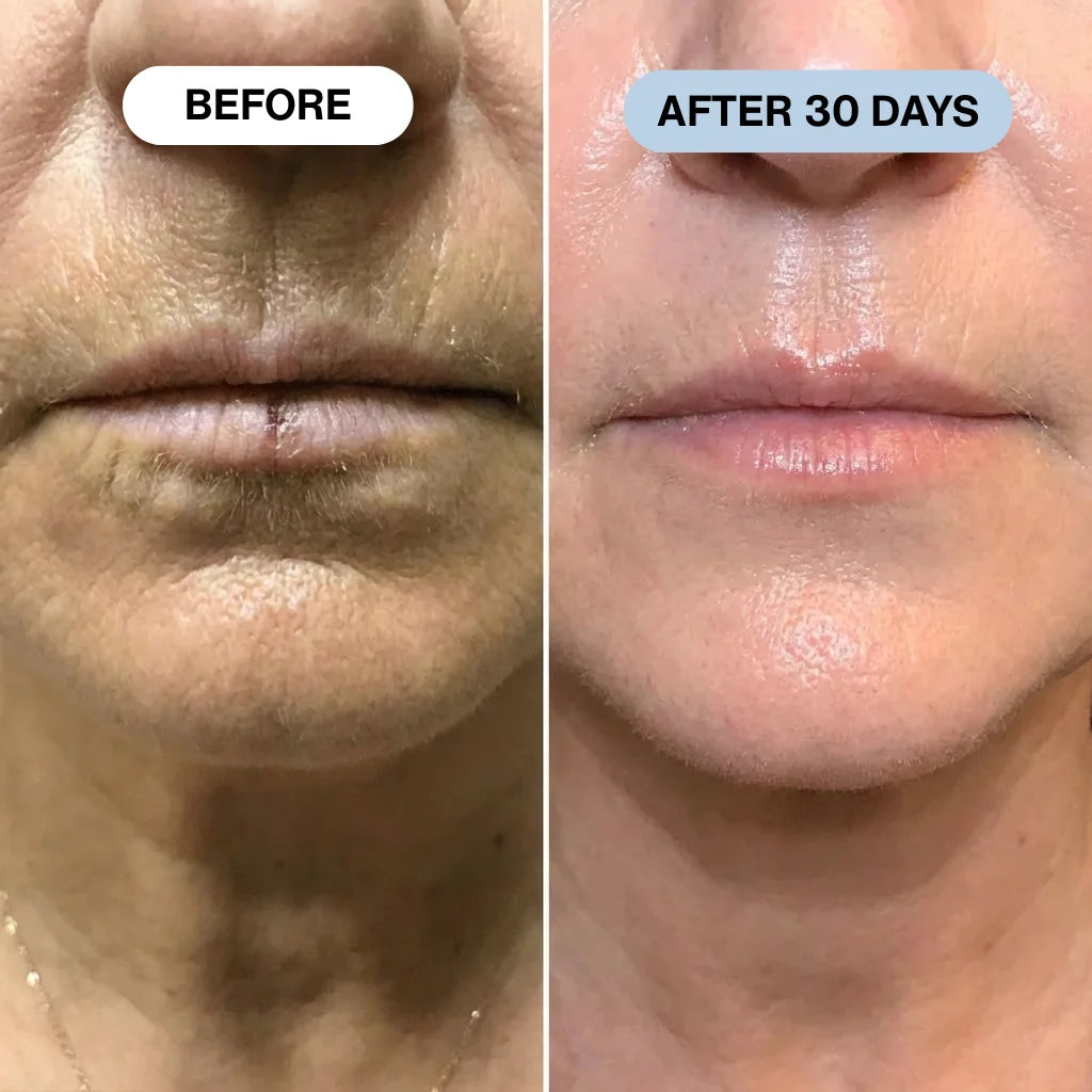 Ryte Copper Peptide Micro-Infusion System