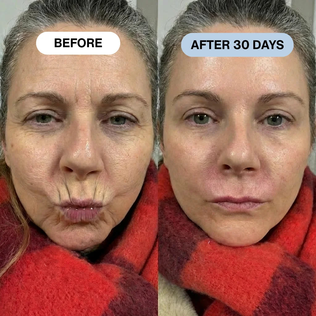 Ryte Copper Peptide Micro-Infusion System