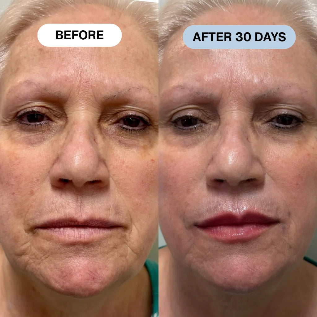 Ryte Copper Peptide Micro-Infusion System