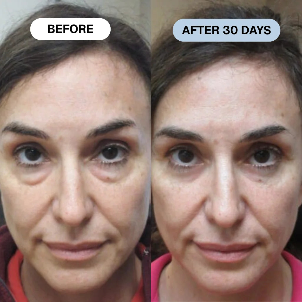 Ryte Copper Peptide Micro-Infusion System