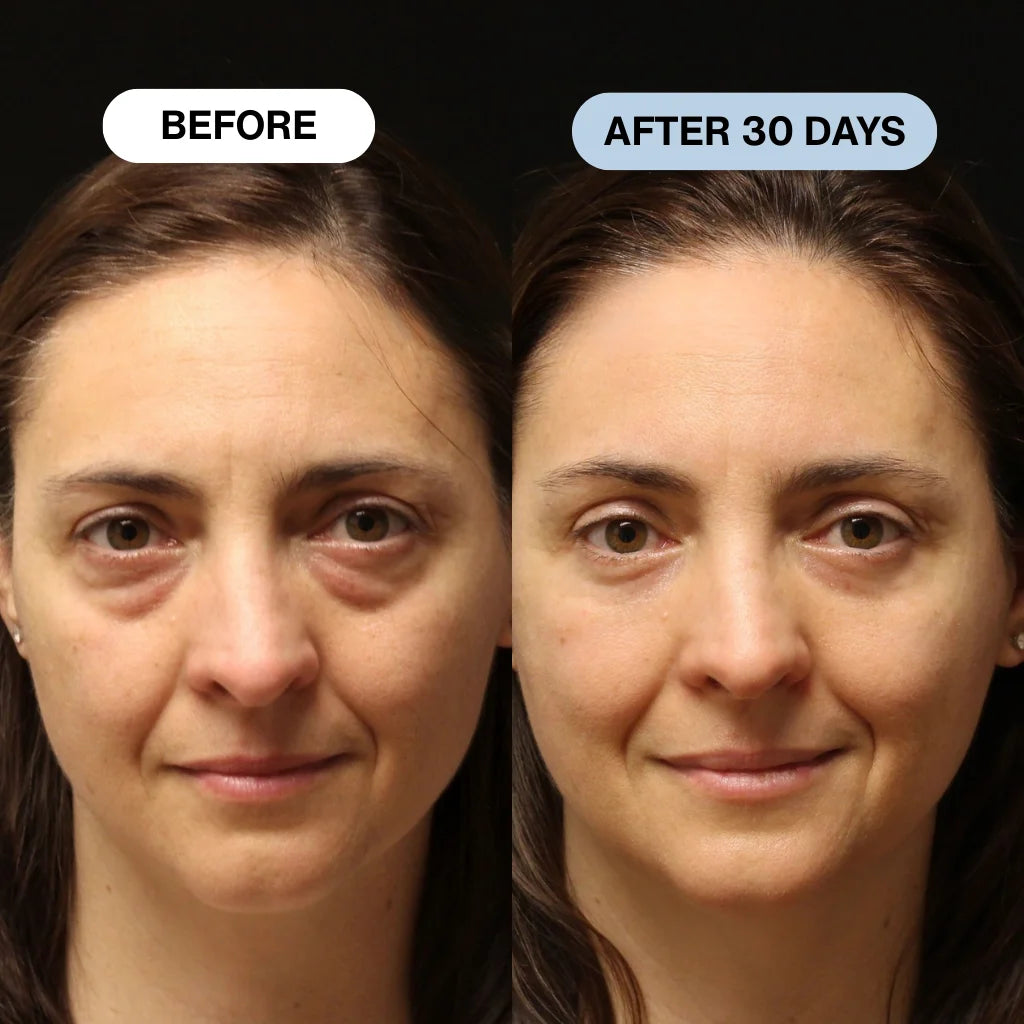 Ryte Copper Peptide Micro-Infusion System