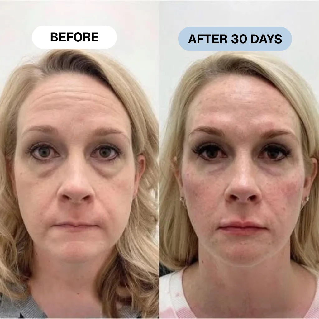 Ryte Copper Peptide Micro-Infusion System