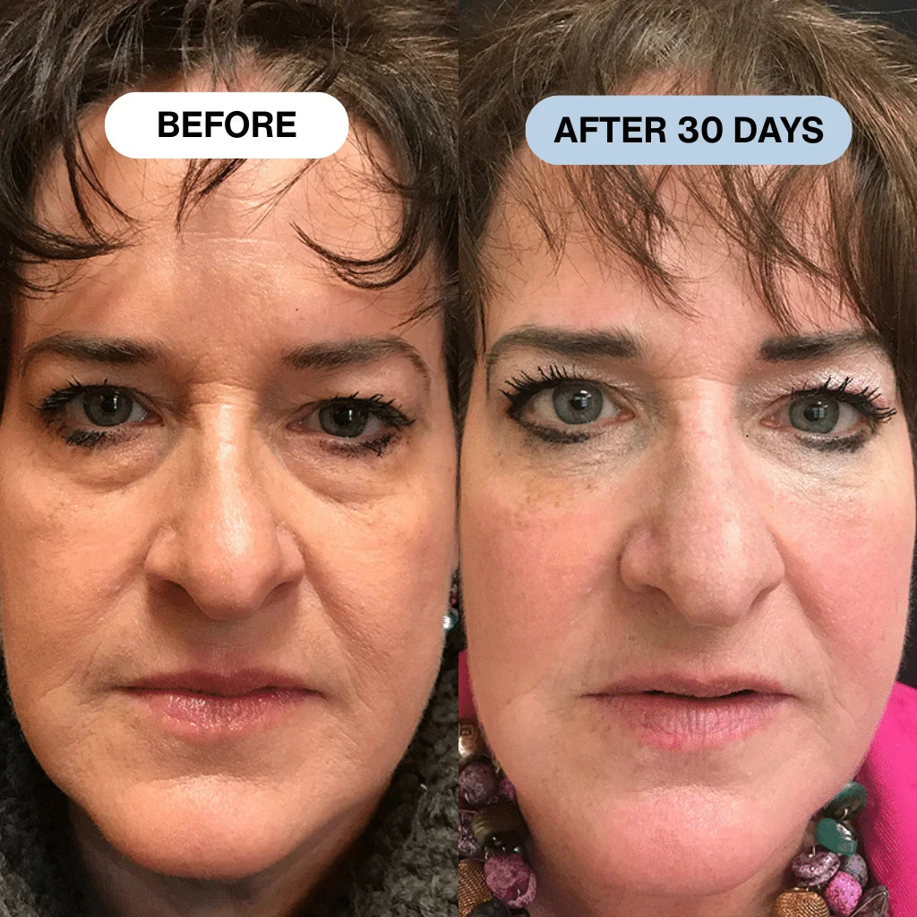 Ryte Copper Peptide Micro-Infusion System